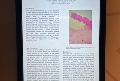Pesquisa desenvolvida no curso de Medicina, do UniFACEF, é apresentada em um dos maiores congressos mundiais de Dermatologia, na Áustria
